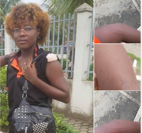 Scandale/ Libert de la presse : une journaliste battue par des gendarmes  Adjame