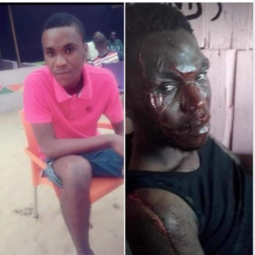 CTE D'IVOIRE/INSOLITE : UN JEUNE DE YOPOUGON DFIGUR PAR DOUZE PERSONNES QU'IL RECONNAIT