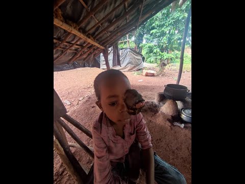 SOS POUR LE PETIT KOUAKOU KOUASSI ATTEINT D'UNE TUMEUR A L'OEIL GAUCHE